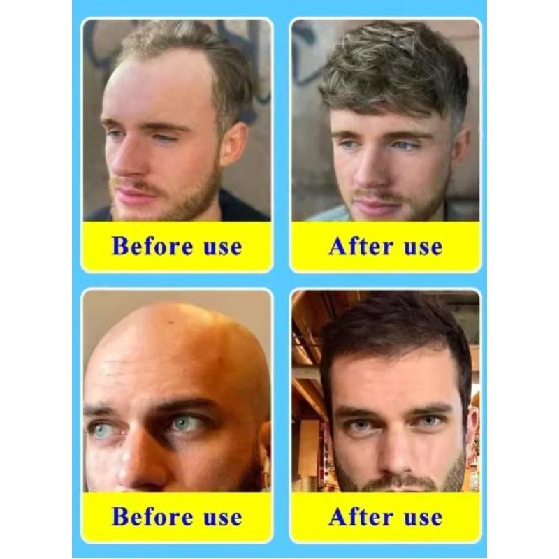 زيت أساسي للعناية بالشعر بالبي - مراجعة Hair Care Collagen وسعره