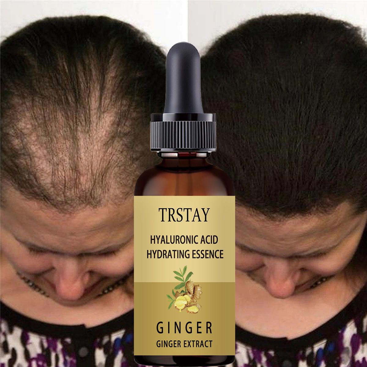 سيروم نمو الشعر المضاد لمنع تس - مراجعة Hair Care Gisou وسعره
